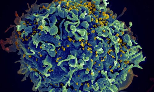 CRISPR gene editing could kill HIV. But is it a cure?