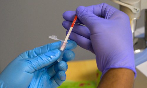 Massachusetts supervised injection sites would slash opioid overdose deaths: Department of Public Health