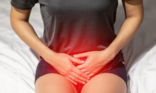 The Essential Guide to Urinary Tract Infections: Symptoms, Causes, Treatments, and Natural Approaches