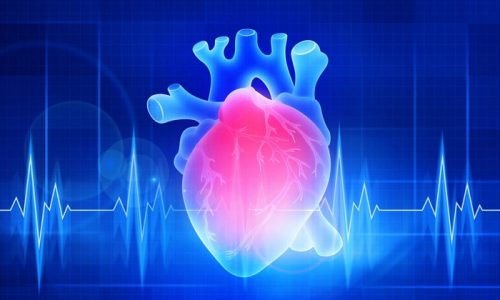 Far More Complex Than Fat: What Is Causing Heart Disease