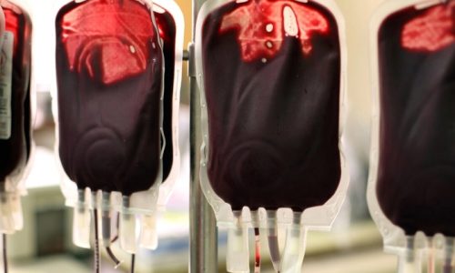 Researchers Concerned About Blood Transfusions From Vaccinated and Long-COVID Patients, Propose Changes