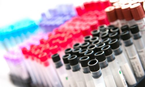 F.D. Flam: Do you really want to find out if you’ll get Alzheimer’s?