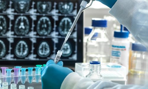 Joe Grogan: Access to new Alzheimer’s treatments bogged down by Medicare policy