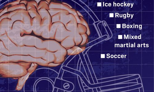 Boston University CTE study finds link between contact sports, CTE, Parkinson’s disease-like symptoms