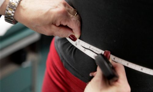 Severe obesity is on the rise in the US