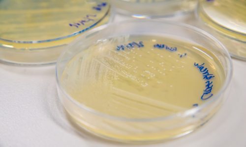 Drug-resistant germs will kill millions more people in coming decades, researchers warn