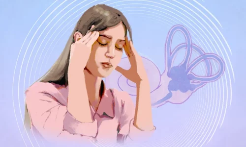 Vertigo: Symptoms, Causes, Treatments, and Natural Approaches