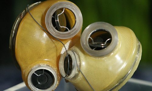 Today in History: December 2, first permanent artificial heart implanted