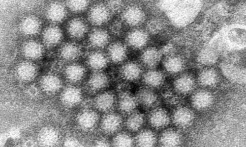 Nasty norovirus is back in full force with US cases of the stomach virus surging