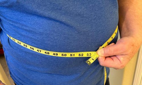 Obesity won’t be solely defined by BMI under new plan for diagnosis by global experts