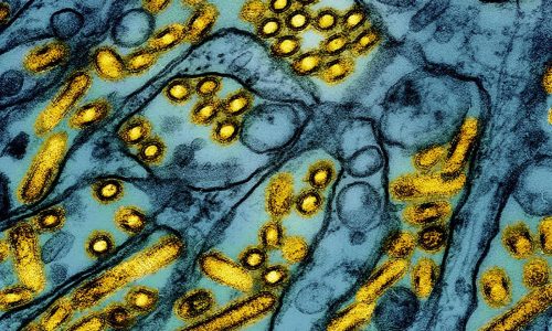 New strain of bird flu is detected in a Nevada dairy worker, CDC says
