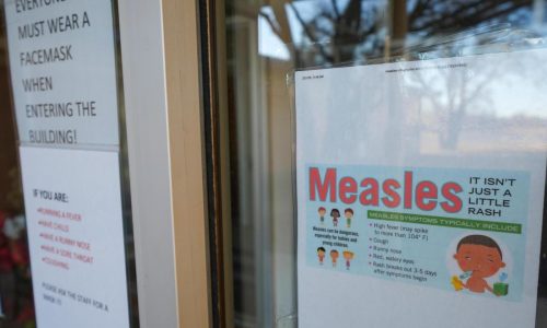Texas measles cases rise to 146 in an outbreak that led to a child’s death