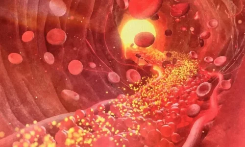 Beyond Cholesterol Lies a New Approach to Heart Health