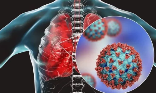 Innovative Therapy Reverses Lung and Nerve Damage from COVID-19
