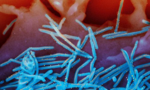 Experts make new recommendations on RSV and meningitis vaccines, but it’s unclear what happens next