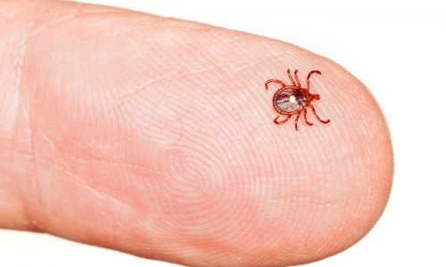 Editorial: ’Tis the season to be on your guard for ticks