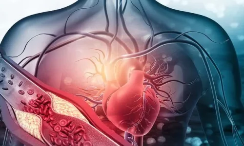 Silent Threats: How to Detect and Prevent Deadly Blood Clots Before It’s Too Late