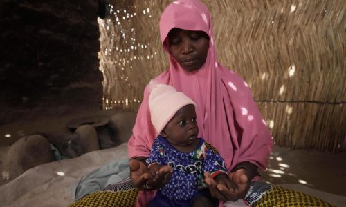 Children die as USAID aid cuts snap a lifeline for the world’s most malnourished