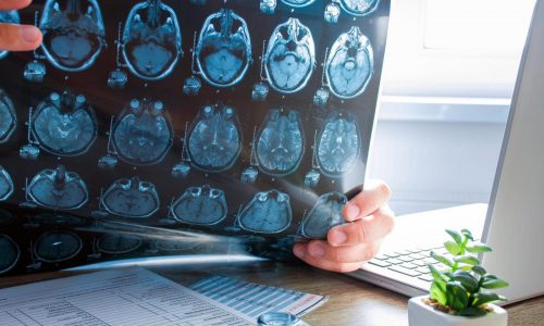 Natural disasters may be shaping babies’ brains