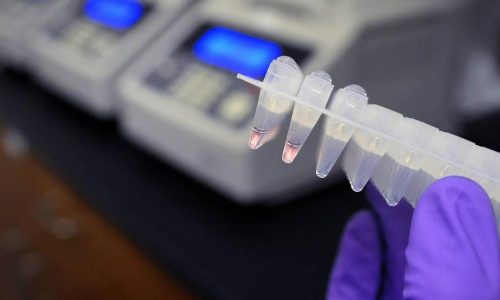 More states are tracking rape kits. But key support for survivors may be slipping away