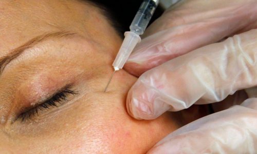 Botulism cases tied to Botox injections at Milton spa, state warns