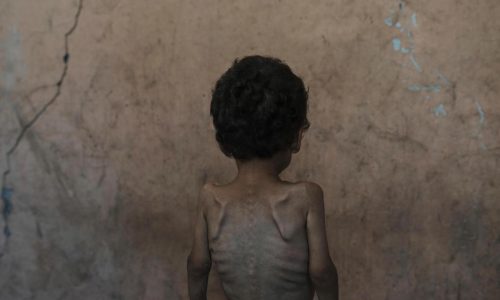 ‘Worst-case scenario of famine’ is happening in Gaza, food crisis experts warn