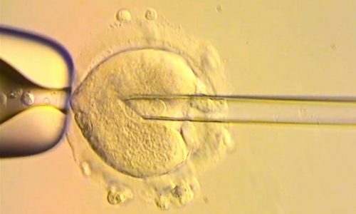 Healthy babies born in Britain after scientists used DNA from three people to avoid genetic disease