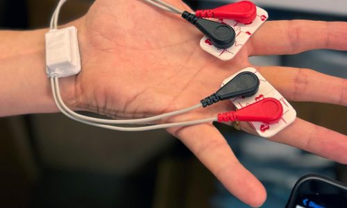 Is baby getting enough breastmilk? New device helps moms learn