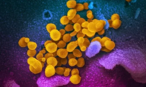 COVID-19 Activity Increases Across US, Mostly on West Coast: CDC