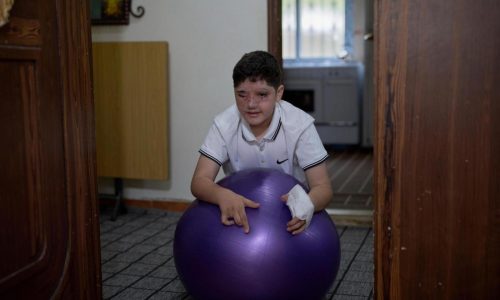 Survivors of Israel’s pager attack on Hezbollah last year struggle to recover