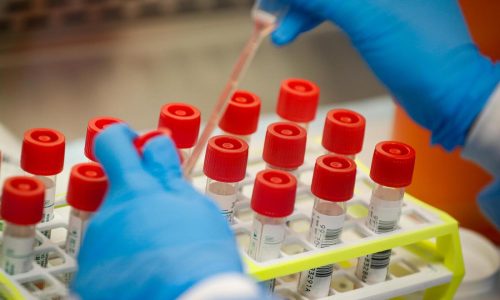 EPA scientist at Duluth lab says he was fired after signing ‘Declaration of Dissent’