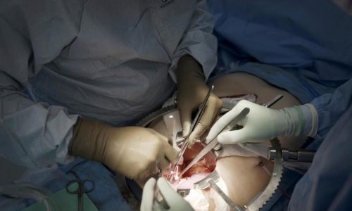 First clinical trial of pig kidney transplants gets underway