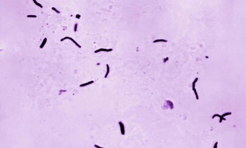 Global tuberculosis diagnoses rise to a record, but deaths fall, WHO reports