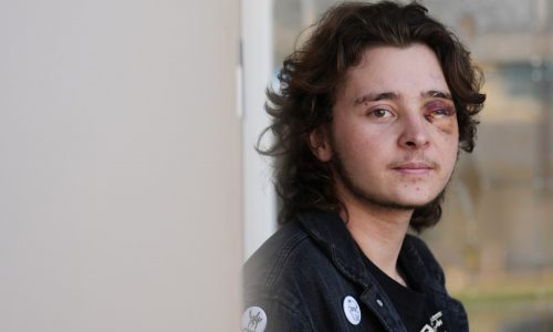 Demonstrator injured after federal agent fired projectile from close range during California protest