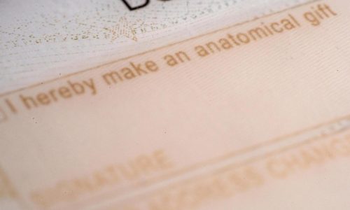 Public mistrust linked to drop in deceased donor organ donations and kidney transplants