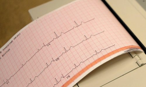 What is atrial fibrillation and how is it treated?
