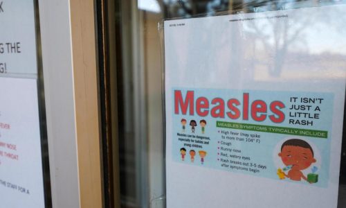 Massachusetts reports first measles cases of year: ‘Getting vaccinated is the best way for people to protect themselves’