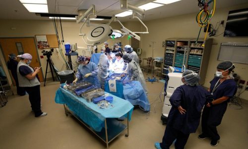 More organs are being donated after the heart stops, not brain death. Policies are changing too