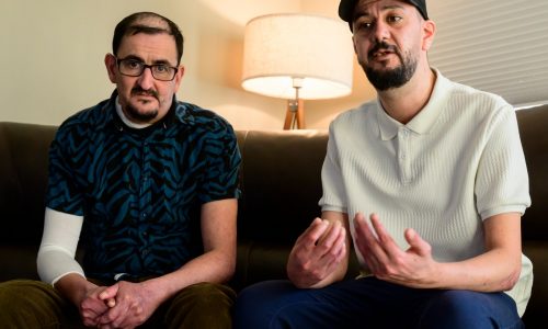 Woodbury man with rare skin condition recovering from ICE detention, still ‘scared to go out’